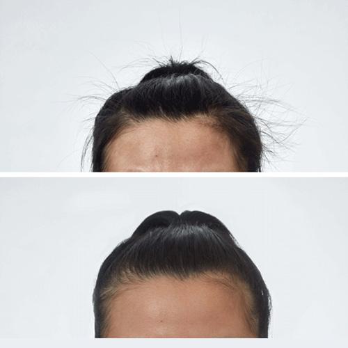 Thin Lizzy Smooth Hair Wand before and after