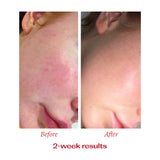 TRILOGY Vit C Booster Treat. 15ml